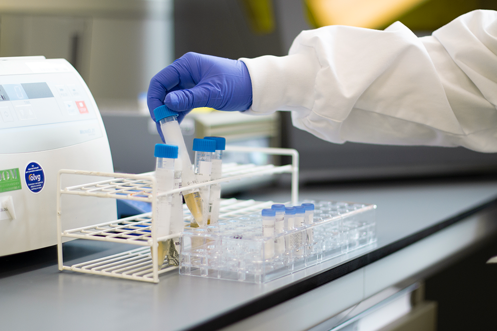 Afbeelding van een urineonderzoek in het laboratorium