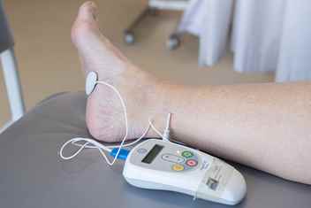 Foto van voet met PTNS-behandeling