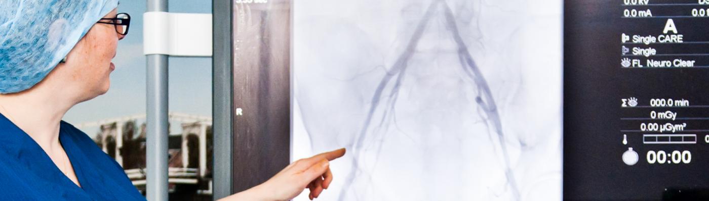 Foto van een zorgverlener die iets aanwijst op een scanbeeld