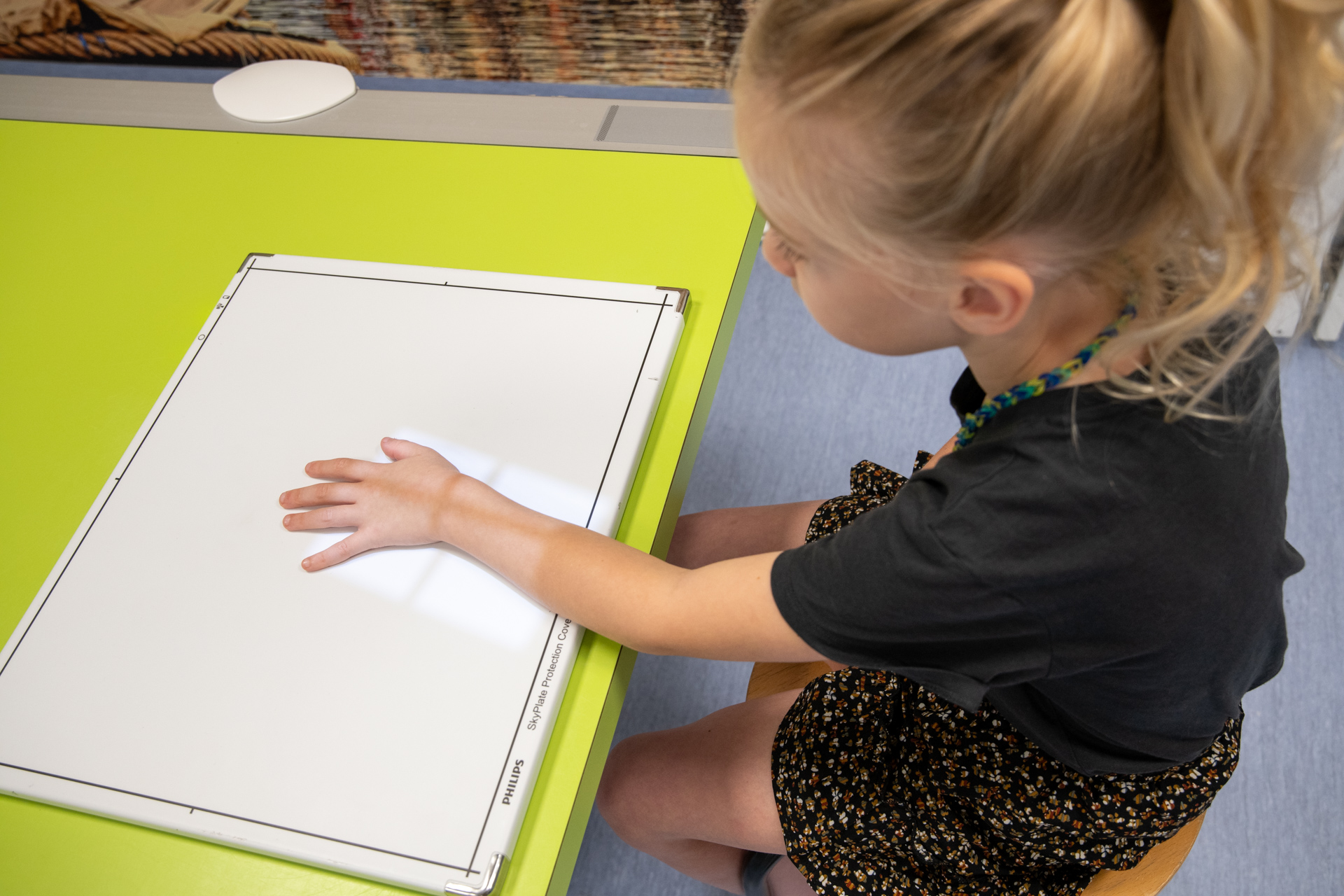 patient met arm op rontgen tafel